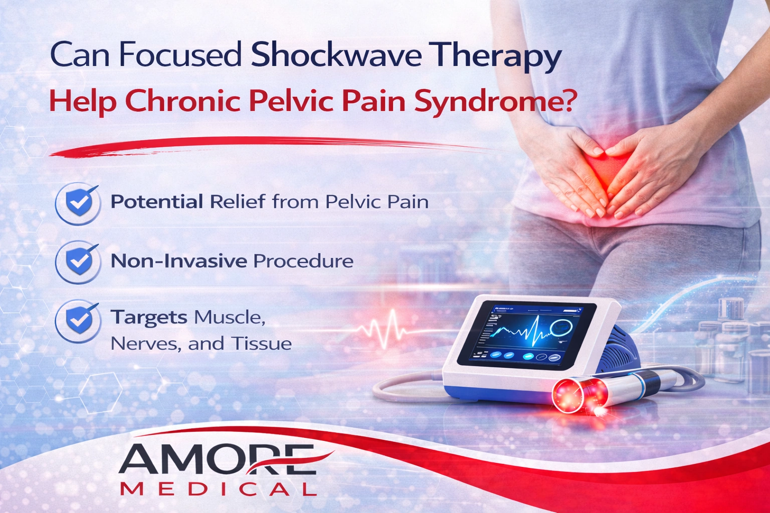 Can Focused Shockwave Therapy Help Chronic Pelvic Pain Syndrome?